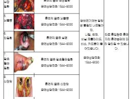 보건복지부, 담뱃갑 경고그림·문구 교체로 흡연 위험성 경고 강화 기사 이미지